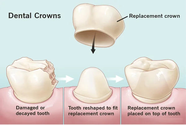 Crown